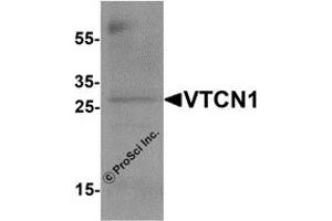 Western Blotting (WB) image for anti-V-Set Domain Containing T Cell Activation Inhibitor 1 (VTCN1) antibody (ABIN1077428) (VTCN1 antibody)