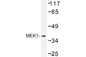 Image no. 1 for anti-Mitogen-Activated Protein Kinase Kinase 1 (MAP2K1) antibody (ABIN317881) (MEK1 antibody)