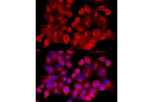 Immunofluorescence analysis of HeLa cells using Clathrin heavy chain antibody (ABIN6131586, ABIN6138752, ABIN6138754 and ABIN6216041) at dilution of 1:100 (40x lens).