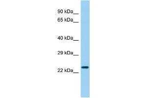 Host: Rabbit Target Name: LHFPL4 Sample Type: Fetal Heart lysates Antibody Dilution: 1. (LHFPL4 antibody  (C-Term))