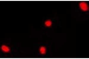 Immunofluorescent analysis of DDX41 staining in Hela cells. (DDX41 antibody)