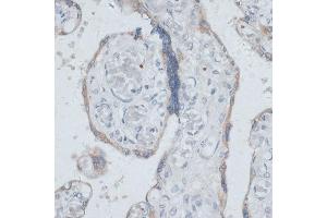 Immunohistochemistry of paraffin-embedded human placenta using DTNBP1 antibody (ABIN7266870) at dilution of 1:100 (40x lens). (DTNBP1 antibody  (AA 1-351))