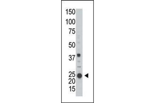 ARL3 antibody  (C-Term)