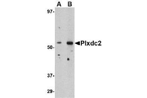 Image no. 1 for anti-Plexin Domain Containing 2 (PLXDC2) (N-Term) antibody (ABIN1494345) (PLXDC2 antibody  (N-Term))
