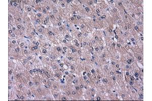 Immunohistochemical staining of paraffin-embedded liver tissue using anti-L1CAMmouse monoclonal antibody. (L1CAM antibody)