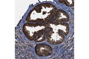 Immunohistochemical staining of human prostate shows nuclear and cytoplasmic positivity in glandular cells. (FNTA antibody)