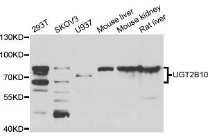 Western blot analysis of extracts of various cell lines, using UGT2B10 antibody. (UGT2B10 antibody)