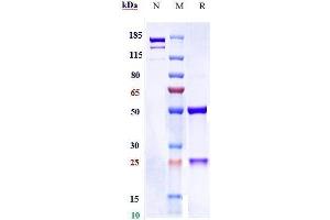 Anti-HBsAg Reference Antibody (OST 577) on SDS-PAGE under reducing (R) condition.