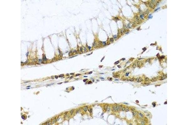 PMPCB antibody