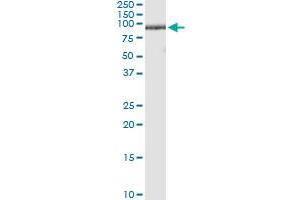 Immunoprecipitation of ZNF496 transfected lysate using anti-ZNF496 MaxPab rabbit polyclonal antibody and Protein A Magnetic Bead , and immunoblotted with ZNF496 purified MaxPab mouse polyclonal antibody (B01P) .