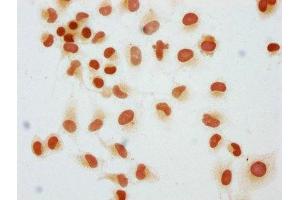 Immunocytochemistry analysis of ABIN7139603 diluted at 1:25 and staining in Hela cells performed on a Leica BondTM system. (HIST1H1C antibody  (meLys45))