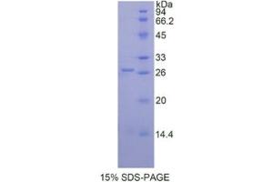 SDS-PAGE (SDS) image for Proteinase 3 (PRTN3) (AA 24-249) protein (His tag) (ABIN1099415)