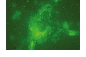 Immunofluorescence (IF) image for anti-Lysosomal-Associated Membrane Protein 2 (LAMP2) antibody (ABIN7211532) (LAMP2 antibody)