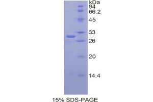 SDS-PAGE analysis of Human Cathepsin C Protein.