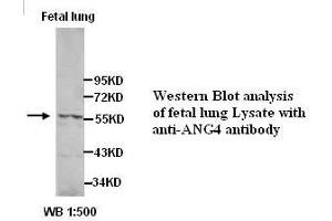 Image no. 1 for anti-Angiopoietin 4 (ANGPT4) (Internal Region) antibody (ABIN791095) (Angiopoietin 4 antibody  (Internal Region))