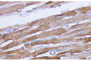 Immunohistochemistry of paraffin-embedded Rat heart using NDUFB7 Polyclonal Antibody at dilution of 1:100 (40x lens). (NDUFB7 antibody)