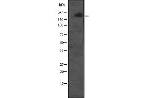 Western blot analysis of CUL7 expression in Molt-4 cell lysate ;,The lane on the left is treated with the antigen-specific peptide. (Cullin 7 antibody  (C-Term))