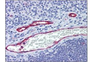 Human Thymus, Vessels: Formalin-Fixed, Paraffin-Embedded (FFPE) (DARC antibody  (N-Term))