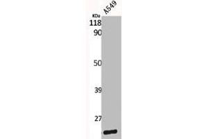 Western Blot analysis of A549 cells using Caveolin-1 Polyclonal Antibody (Caveolin-1 antibody  (C-Term))