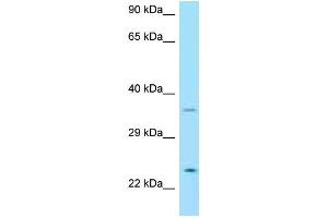 Western Blotting (WB) image for anti-Neurturin (NRTN) (C-Term) antibody (ABIN2774377) (Neurturin antibody  (C-Term))