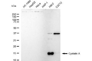 Western blotting analysis using Cystatin A antibody (ABIN7798236).