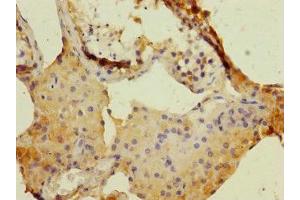 Immunohistochemistry of paraffin-embedded human testis tissue using ABIN7150689 at dilution of 1:100 (DUOX1 antibody  (AA 1312-1551))