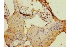 Immunohistochemistry of paraffin-embedded human testis tissue using ABIN7150689 at dilution of 1:100