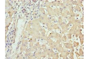Immunohistochemistry of paraffin-embedded human liver tissue using ABIN7162026 at dilution of 1:100 (NUPL2 antibody  (AA 1-224))