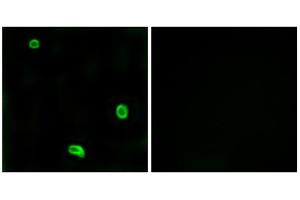 Immunofluorescence analysis of LOVO cells, using PAR4 antibody. (F2RL3 antibody  (Internal Region))