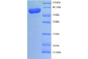 SDS-PAGE (SDS) image for Interleukin 12 beta (IL12B) (AA 23-328) protein (GST tag) (ABIN5712492)