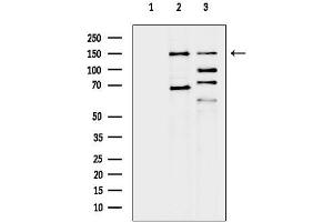 Western blot analysis of lysates from various samples, using c-Met Antibody.