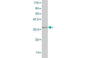 Western Blot detection against Immunogen (35. (LYPLA2 antibody  (AA 144-231))