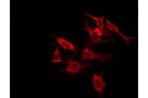OR5M11 antibody  (C-Term)
