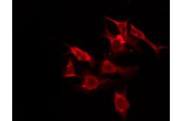OR5M11 antibody  (C-Term)