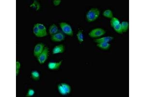 Immunofluorescent analysis of MCF-7 cells using ABIN7153163 at dilution of 1:100 and Alexa Fluor 488-congugated AffiniPure Goat Anti-Rabbit IgG(H+L) (FFAR2 antibody  (AA 277-330))