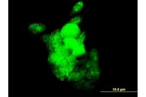 Immunofluorescence of monoclonal antibody to SMOC1 on A-431 cell. (SMOC1 antibody  (AA 150-221))