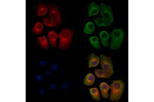 ABIN6265140 and ABIN6279834 staining Hela cells by IF/ICC.