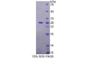 SDS-PAGE analysis of Human NIN Protein.