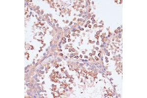 Immunohistochemistry of paraffin-embedded mouse testis using MRPL41 antibody (ABIN7268572) at dilution of 1:100 (40x lens). (MRPL41 antibody  (AA 1-137))