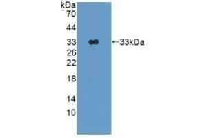 Detection of Recombinant OAS1, Rat using Polyclonal Antibody to 2',5'-Oligoadenylate Synthetase 1 (OAS1)