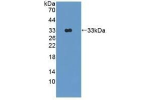 Detection of Recombinant OAS1, Rat using Polyclonal Antibody to 2',5'-Oligoadenylate Synthetase 1 (OAS1) (OAS1 antibody  (AA 139-358))