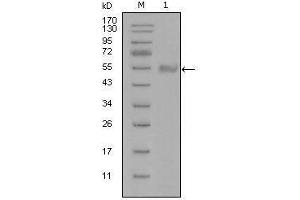Western blot analysis using SYT1 mouse mAb against truncated Trx-SYT1 recombinant protein (1). (SYT1 antibody)