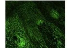 Anti-Rab9b Ab at 1/500 dilution, lysates at 100 µg per Iane, rabbit polyclonal to goat lµg (HR? (RAB28 antibody  (C-Term))