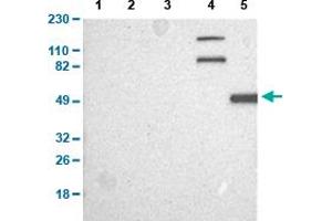 Western Blot analysis of (1) human cell line RT-4, (2) human cell line U-251MG sp, (3) human plasma (IgG/HSA depleted), (4) human liver tissue, and (5) human tonsil tissue. (CAPN10 antibody  (AA 146-245))