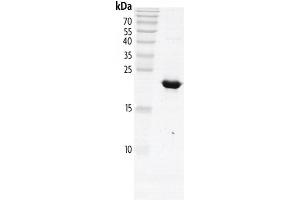 Recombinant PBRM1 (613-734) protein gel. (Polybromo 1 Protein (PBRM1) (AA 613-734) (His tag,DYKDDDDK Tag))