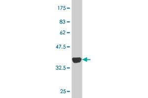 Western Blot detection against Immunogen (33. (Ubiquilin 2 antibody  (AA 555-624))