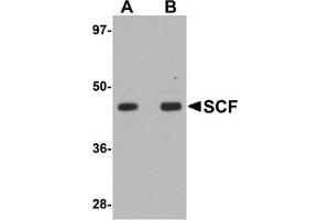 Western Blotting (WB) image for anti-KIT Ligand (KITLG) (Middle Region) antibody (ABIN1031079) (KIT Ligand antibody  (Middle Region))