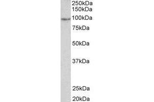 Western Blotting (WB) image for anti-phosphodiesterase 4B, cAMP-Specific (PDE4B) (C-Term) antibody (ABIN2464994) (PDE4B antibody  (C-Term))