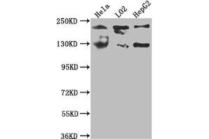 Western Blot Positive WB detected in: Hela whole cell lysate, L02 whole cell lysate, HepG2 whole cell lysate All lanes: MGEA5 antibody at 1:1000 Secondary Goat polyclonal to rabbit IgG at 1/50000 dilution Predicted band size: 103, 96, 77, 97 kDa Observed band size: 130 kDa (Recombinant MGEA5 antibody)