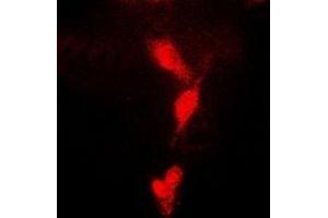 Immunofluorescent analysis of CDC34B staining in MCF7 cells. (UBE2R2 antibody)